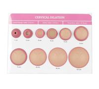 XCSCUK Modèle de Dilatation cervicale, simulateur de Dilatation cervicale de 0 à 10 cm, modèle d'examen gynécologique, pour la Formation des sages-Femmes et des Doulas