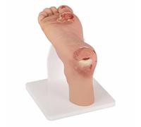 XCSCUK Modèle de soins des pieds diabétiques, modèle de pathologie du pied, modèle médical d'ulcère du pied, aide pédagogique sur la déformation du pied, pour étudiant en médecine (léger)