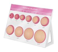 XCSCUK Simulateur de Dilatation cervicale, simulateur de Dilatation cervicale en 10 étapes pour Femmes Enceintes, pour l'éducation à l'accouchement, Formation des sages-Femmes