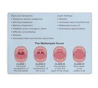 XGINERFEX Airway Anatomy Assessment Poster Mallampati Classification and OSA Clinical Signs Educational Chart Wall-Art(Framed,16x24inch(40x60cm))