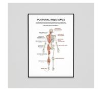 XGINERFEX Chiropractic Educational Poster Effects of Postural Imbalance Spinal Alignment Wall-Art for Health Clinic Hospital Office Decor Canvas Painting Print(Unframed,16x24inch(40x60cm))