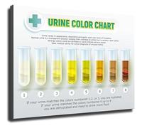 XGINERFEX Dehydration Chart Urine Color Guide Poster Visual Tool for Doctors Clinic Classroom Gym Office Home Health Awareness(Unframed,08x12inch(20x30cm))