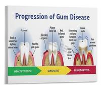 XGINERFEX Gum Disease Stages Poster Periodontitis Educational Chart Clinic Reference Canvas Print Wall-Art(Framed,08x12inch(20x30cm))