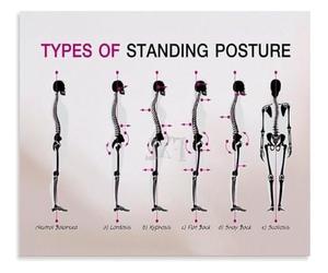 XGINERFEX Types of Poor Standing Posture Leading to Back Issues Poster Corrective Posture Chart Wall Decor Print(Unframed,16x24inch(40x60cm))