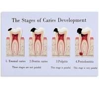 XGINERFEX Understanding Oral Wellness Tooth Diagram Poster Canvas Wall-Art for Holistic Practice Reception or Modern Apartment(Framed,08x12inch(20x30cm))