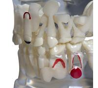 Xiaoxu Modèle Dentaire Transparent pour Dents Malades, modèle Dentaire Transparent pour Enfants présentant des Dents primaires et des Dents de Lait à des Fins pédagogiques et de démonstration.