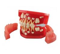 Xiaoxu Typodontes dentaires Mode Dentaire 3-12 Ans Croissance constante des Dents Remplacement Démonstration Anatomie Enseignement Étude (7013)