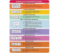 XingFox Plaques métalliques vintage en métal pour connaissances en cardiologie, guide d'interprétation rapide de l'ECG, affiches rétro, cliniques, hôpitaux, bureaux, décoration murale, 20 x 30 cm