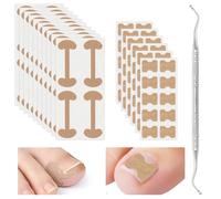 Xinzan 2 types de patchs de traitement des ongles incarnés avec outil pour ongles incarnés, outils professionnels de correction d'ongles incarnés pour le soin des ongles des orteils, protéger les