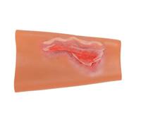 Xiuganpo Modèle de Traumatisme du Bras en Silicone avec Simulation de Plaie par Abrasion, Aide Pédagogique pour la Formation aux Premiers Secours
