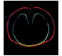 Xtc - Wasp Star (Apple Venus Vol. Ii) [Compact Discs] Uk - Import