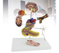 XYFGODEM Modèle de diabète composé de 8 pièces, pour médecine humaine, complications pour l'enseignement de l'anatomie et de la physiologie humaines