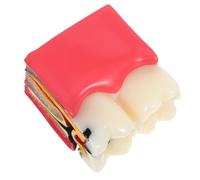 YARNOW Modèle Pédagogique Visualisation Améliorée en Résine et Design Comparatif D'anatomie Comparée des Caries Dentaires pour Écoles et Étudiants