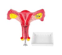 yasoe 1:1 Humain UtéRus Ovaire Trompes de Fallope Modèle Anatomique Anatomie Humaine Modèle Outils PéDagogiques