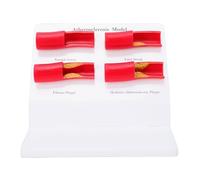 Yinhing Modèle D'athérosclérose Humaine, écran Cardiovasculaire ABS avec Plaque Amovible et Surfaces Lisses, pour les Démonstrations Cliniques en Laboratoire en Classe
