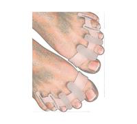 Yogamedic Toe Separator for Overlapping Toes 6pcs Improved Silicone, 0% Bpa, Onesize Bunion Corrector Toe Straightener To Relax, Spread And Stretch -