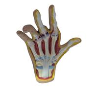 Yominerr Modèle de main avec arthrose, modèle de pathologie de la main, réplique de l'anatomie et de la physiologie humaines, modèle anatomique pour la pratique médicale