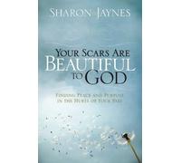 Your Scars Are Beautiful to God: Finding Peace and Purpose in the Hurts of Your Past