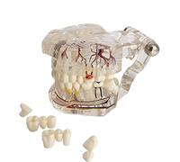 YOUYA DENTAL Modèle dentaire de réparation neurale - Modèle dentaire - Modèle d'implant - Modèle dentaire standard - Modèle d'enseignement des dents pathologiques amovibles pour les dentistes
