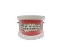 YOUYA DENTAL - Modèle orthodontique dentaire - Outil d'enseignement des dents avec support autobloquant 1/2 métal et 1/2 métal (rouge)