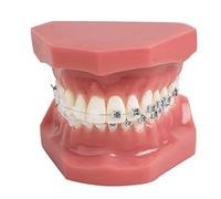 YOUYA Dental TM-208 Outil de démonstration orthodontique avec support en métal et en céramique (rouge)