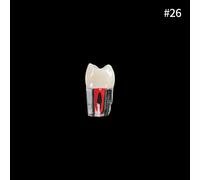 Youya-Dents Endodontiques Dentaires,Canal Radiculaire,Modèle D'entraînement,Simulation Dentaire,Rct,Pratique De La Pulpe,Cavité,Fuchsia,Étude,1 Pièce - Type 1pcs Number 26