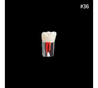 Youya-Dents Endodontiques Dentaires,Canal Radiculaire,Modèle D'entraînement,Simulation Dentaire,Rct,Pratique De La Pulpe,Cavité,Fuchsia,Étude,1 Pièce - Type 1pcs Number 36