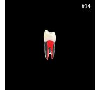 Youya-Dents Endodontiques Dentaires,Canal Radiculaire,Modèle D'entraînement,Simulation Dentaire,Rct,Pratique De La Pulpe,Cavité,Fuchsia,Étude,1 Pièce - Type 1pcs Number 14