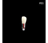 Youya-Dents Endodontiques Dentaires,Canal Radiculaire,Modèle D'entraînement,Simulation Dentaire,Rct,Pratique De La Pulpe,Cavité,Fuchsia,Étude,1 Pièce - Type 1pcs Number 11