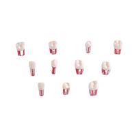 YRQMGSF 11 Pcs Dental Endodontic Root Canal Practice Endo Teeth Modèle de dent Examen d'enseignement Dentaire Open Pulp Pellet Practice Model