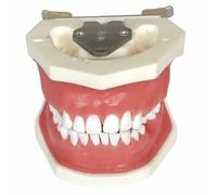 YRQMGSF Modèle de maladie parodontale - Enseignement de la pathologie Modèle parodontal - pour la Recherche Dentiste médical Enseignement Études