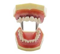 YRQMGSF Modèle de typodont de Dents dentaires, modèle de Classification parodontale pour la parodontopathie, Outil d'explication pour l'enseignement des Maladies parodontales