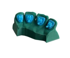 YRQMGSF Modèle Dentaire orthodontique des Dents, modèle de Communication Patient orthodontique imprimé en 3D, pour Les étudiants en odontologie et Les orthodontistes