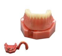 YRQMGSF Modèle d'Implant Dentaire, Modèle d'Explication des Implants Dentaires, Pieu d'Implant, Capuchon, Tige et Plaque Guide