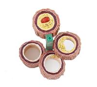 YUANZHOU Modèle De Circulation Sanguine Cardiovasculaire D'athérome D'anatomie Pathologique D'athérome pour l'enseignement Médical