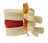YUPVM Modèle de vertèbres lombaires colonne vertébrale anatomique hernie discale lombaire outil d'enseignement de l'anatomie modèle de vertèbres lombaires