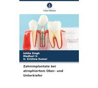 Zahnimplantate bei atrophiertem Ober- und Unterkiefer