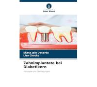 Zahnimplantate bei Diabetikern