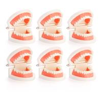 ZENFUN Lot de 6 modèles dentaires de démonstration dentaire pour étudiants, modèle de dents standard, bouche artificielle pour l'enseignement, dentiste, étudiant dentaire, affichage propre