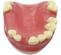 Zghhc Modèle D'implant Dentaire Maxillaire Manquant, Modèle De Dents avec Gencives Souples, Pratique D'implant Dentaire, Formation Médicale, Outils Pédagogiques