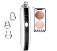 ZHENGE Aspirateur de points noirs intelligent, outil de retrait de points noirs avec caméra HD 1080p, aspirateur de pores de type port USB, nettoyeur de pores pour homme et femme, têtes d'aspiration